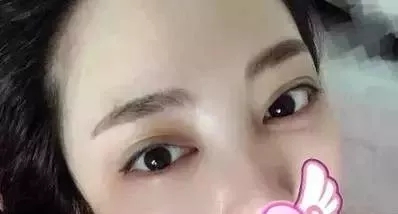 水光,打1次和4次究竟有多大區別?