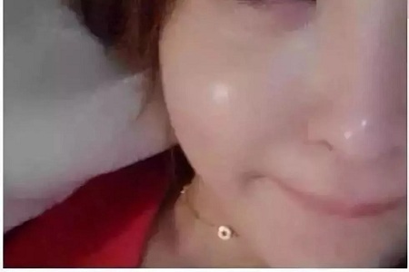 水光,打1次和4次究竟有多大區別?