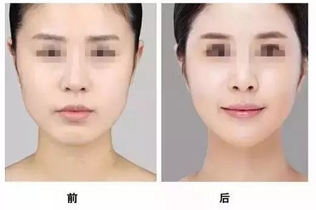 美萊實(shí)驗(yàn)室：瘦臉、ReFa都解決不了你的臉大問題交給我就對(duì)了
