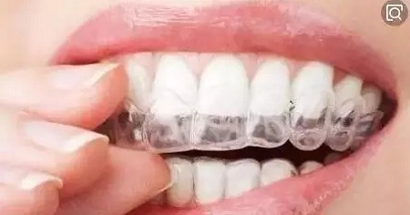 問診室:關于正畸,不止你想的這么簡單喔