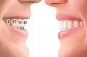 問診室:關于正畸,不止你想的這么簡單喔