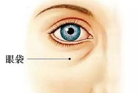 還把眼袋當臥蠶?那就別怪小弟弟喊你阿姨了