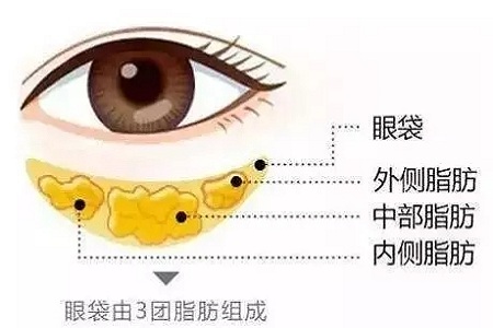 還把眼袋當臥蠶?那就別怪小弟弟喊你阿姨了