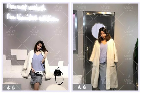 顏值:修復后的雙眼,美瞎一路