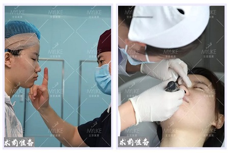 顏值:修復后的雙眼,美瞎一路