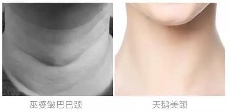 悄咪咪的年輕十歲,撫平頸紋一起“嗨”