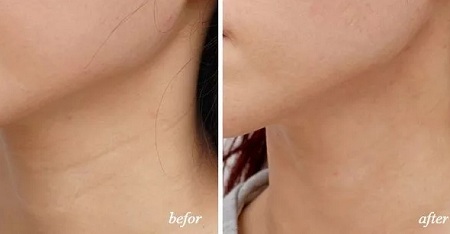 悄咪咪的年輕十歲,撫平頸紋一起“嗨”