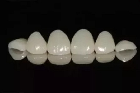 牙齒也能敷“面膜”？這款明星美牙秘籍了解下