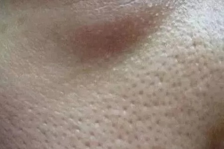 粗糙、毛孔粗大、起皮......換季肌膚問(wèn)題如何解決?