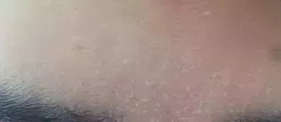 粗糙、毛孔粗大、起皮......換季肌膚問(wèn)題如何解決?