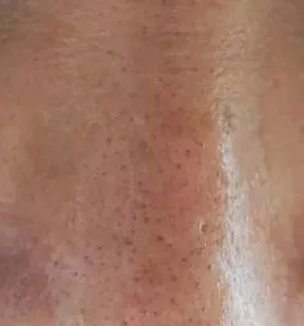 粗糙、毛孔粗大、起皮......換季肌膚問(wèn)題如何解決?