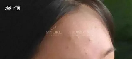 粗糙、毛孔粗大、起皮......換季肌膚問(wèn)題如何解決?