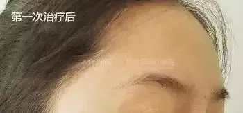 粗糙、毛孔粗大、起皮......換季肌膚問(wèn)題如何解決?