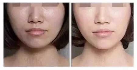 粗糙、毛孔粗大、起皮......換季肌膚問(wèn)題如何解決?