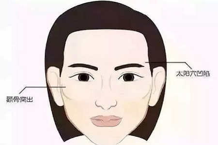 面部填充會不會把臉填大?