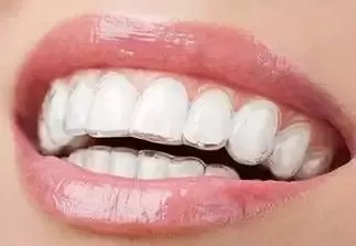 有效數據生成，預見牙齒矯正后的自己