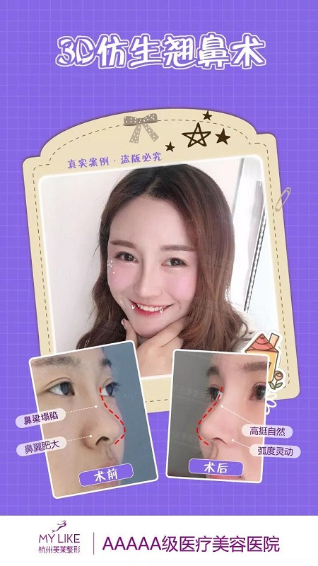 CURE全度美眸,仿生3D翹鼻,想美哪里你來定