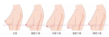一味追求大胸的她們,卻忽略了這個問題...