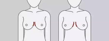 一味追求大胸的她們,卻忽略了這個問題...