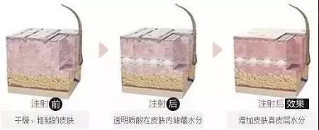 水光迎夏,“針”美麗