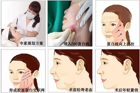 關于*雕,你想了解的都在這里!