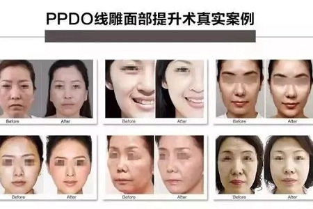 關于*雕,你想了解的都在這里!