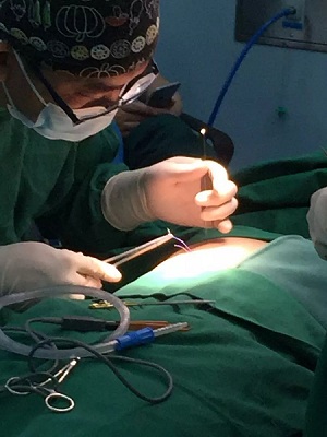 關于鼻整形修復,你需要知道的