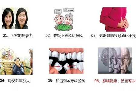 牙齒缺失時，選烤瓷牙還是那種？