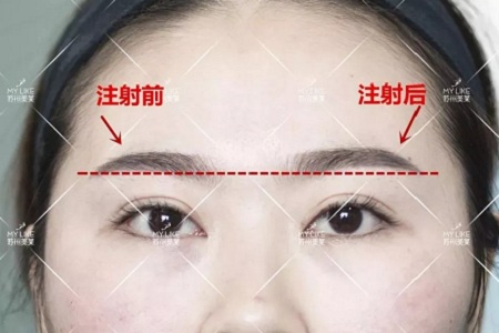 想要?dú)W式大眼,一定要注意與這個(gè)部位協(xié)調(diào)!