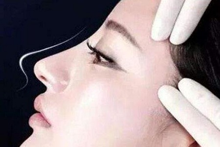 ?隆鼻假體會位移嗎?