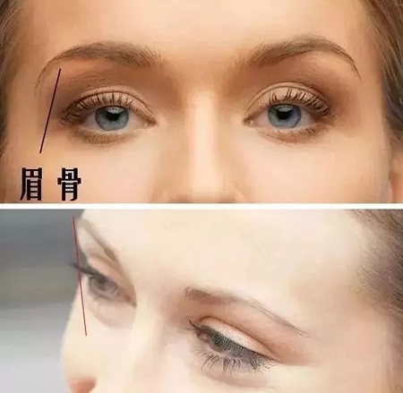 全切?埋線?韓式三點(diǎn)雙眼皮?選擇那種比較好?