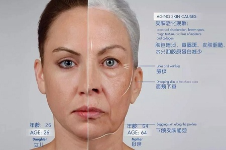 皺紋、松垂、凹陷,三大衰老癥狀,怎么解決?