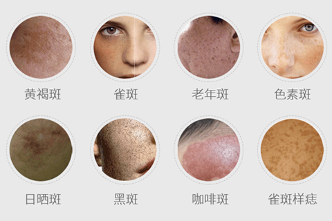 鄭州美萊整形祛斑怎么樣?