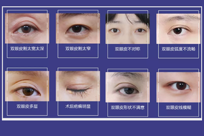 鄭州美萊整形眼修復多少錢?