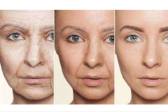 鄭州美萊整形醫院除皺方式有哪些？