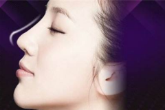 鄭州美萊手術(shù)隆鼻前需要了解的知識(shí)