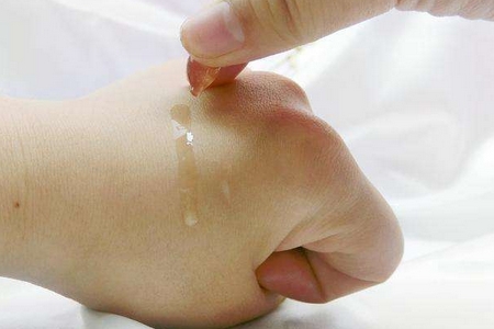 祛斑方法有哪幾種?這些祛斑小妙招你需要掌握