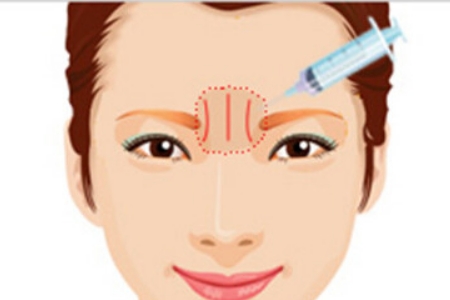 福州自體脂肪維持多久?美萊讓你的脂肪不再迷失方向