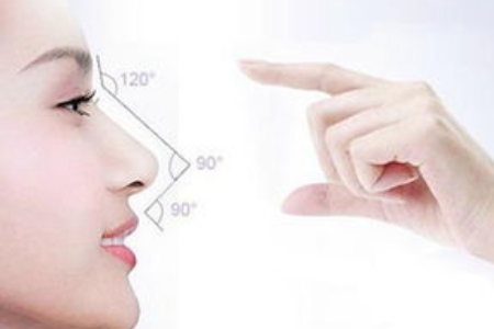 昆明自體組織隆鼻維持多久,效果好嗎?