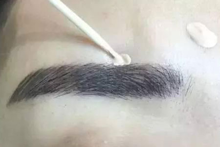 眉毛種植手術過程是怎樣的,多久能看到效果