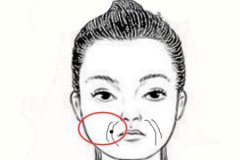 蘇州醫院做法令紋填充一般多少錢，除皺效果好嗎