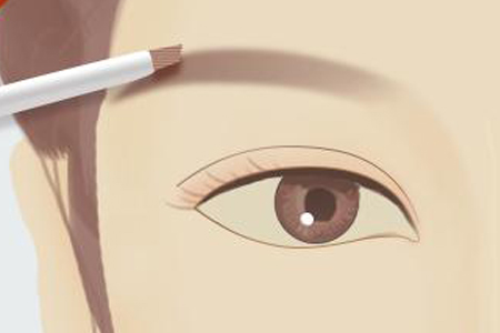 眉毛種植手術過程是怎樣的,多久能看到效果