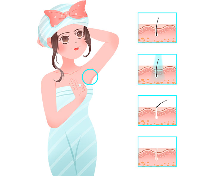 脫毛一般多少錢(qián)