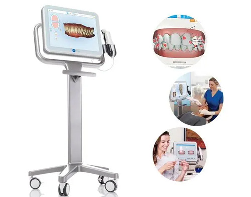 美萊隆重推出雙旦福利，報(bào)名體驗(yàn)牙齒矯正黑科技iTero 口掃