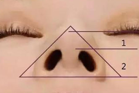 鼻頭大做手術縮小需要多少錢,手術安全嗎?