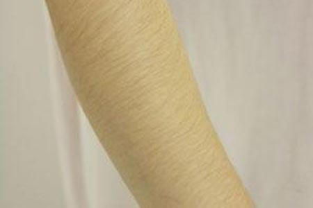 重慶冰點(diǎn)脫毛手臂價(jià)格一般多少錢